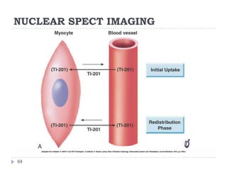 NUCLEAR SPECT IMAGING
64
 