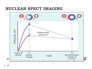 NUCLEAR SPECT IMAGING
69
 