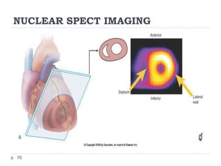 NUCLEAR SPECT IMAGING
70
 