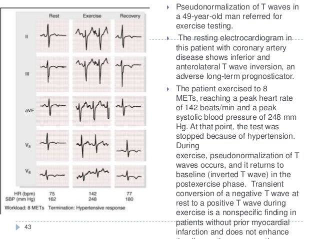 for heart top test t Stress Testing for heart top test t Stress Testing