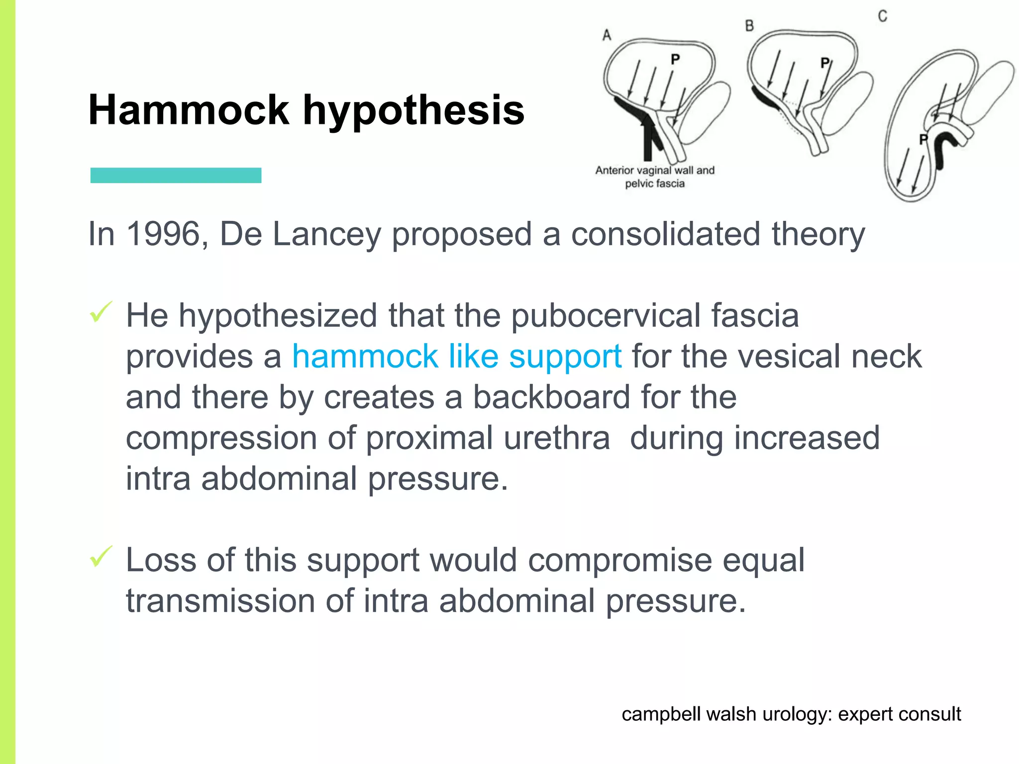 Stress urinary incontinence | PDF