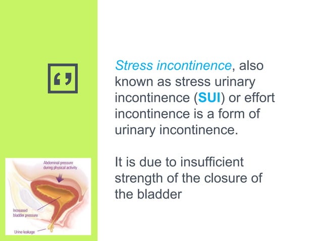 Stress Incontinence Algorithm Stress urinary incontinence | PDF