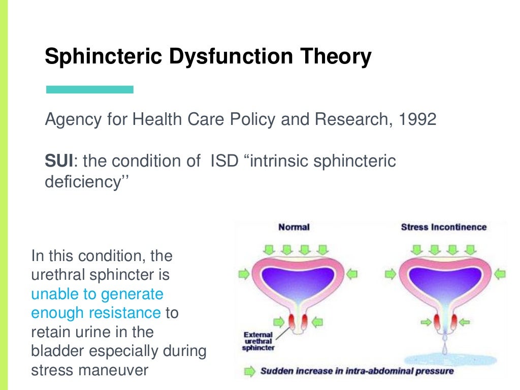 Stress urinary incontinence
