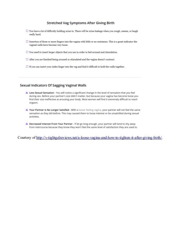 stretched vag symptoms downloadable checklist downloadable checklist