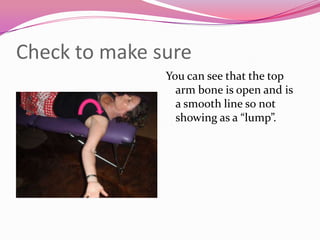 Check to make sure
               You can see that the top
                 arm bone is open and is
                 a smooth line so not
                 showing as a “lump”.
 