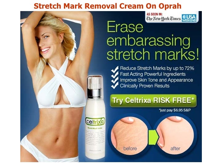 stretch mark eraser cream