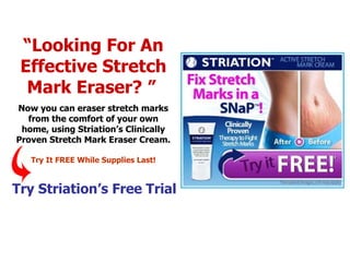 “ Looking For An Effective Stretch Mark Eraser? ”   Now you can eraser stretch marks from the comfort of your own home, using Striation’s Clinically Proven Stretch Mark Eraser Cream. Try It FREE While Supplies Last! Try Striation’s Free Trial 