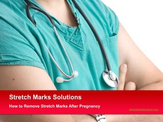 Stretch Marks Solutions
How to Remove Stretch Marks After Pregnancy
                                              stretchmarkproduct.com
 