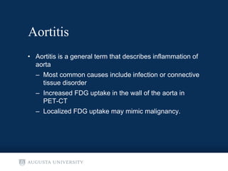 Non-malignant cardiac findings on FDG PET CT | PPT
