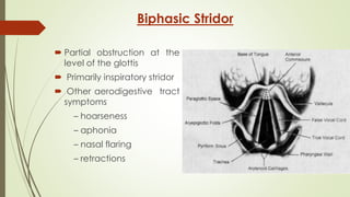 stridor the best -140717124323-phpapp02.pdf
