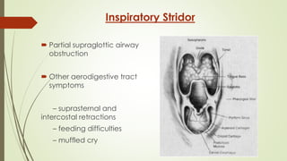 Inspiratory Stridor
 Partial supraglottic airway
obstruction
 Other aerodigestive tract
symptoms
– suprasternal and
intercostal retractions
– feeding difficulties
– muffled cry
 
