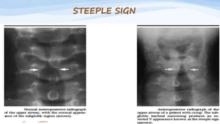 STEEPLE SIGN
Lakshmi11
 