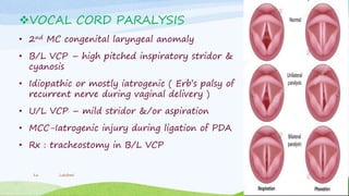 VOCAL CORD PARALYSIS
• 2nd MC congenital laryngeal anomaly
• B/L VCP – high pitched inspiratory stridor &
cyanosis
• Idiopathic or mostly iatrogenic ( Erb’s palsy of
recurrent nerve during vaginal delivery )
• U/L VCP – mild stridor &/or aspiration
• MCC-Iatrogenic injury during ligation of PDA
• Rx : tracheostomy in B/L VCP
Lakshmi16
 