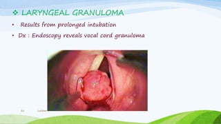  LARYNGEAL GRANULOMA
• Results from prolonged intubation
• Dx : Endoscopy reveals vocal cord granuloma
Lakshmi22
 
