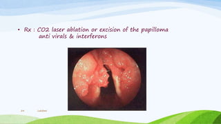 • Rx : CO2 laser ablation or excision of the papilloma
anti virals & interferons
Lakshmi24
 