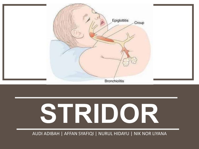 Stridor Scope Stridor | PPTX
