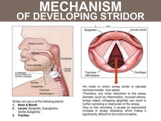 Stridor Pattern Stridor | PPTX