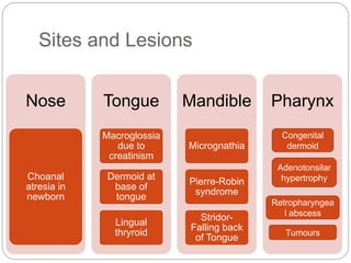 Sites and Lesions
Nose
Choanal
atresia in
newborn
Tongue
Macroglossia
due to
creatinism
Dermoid at
base of
tongue
Lingual
thryroid
Mandible
Micrognathia
Pierre-Robin
syndrome
Stridor-
Falling back
of Tongue
Pharynx
Congenital
dermoid
Adenotonsilar
hypertrophy
Retropharyngea
l abscess
Tumours
 