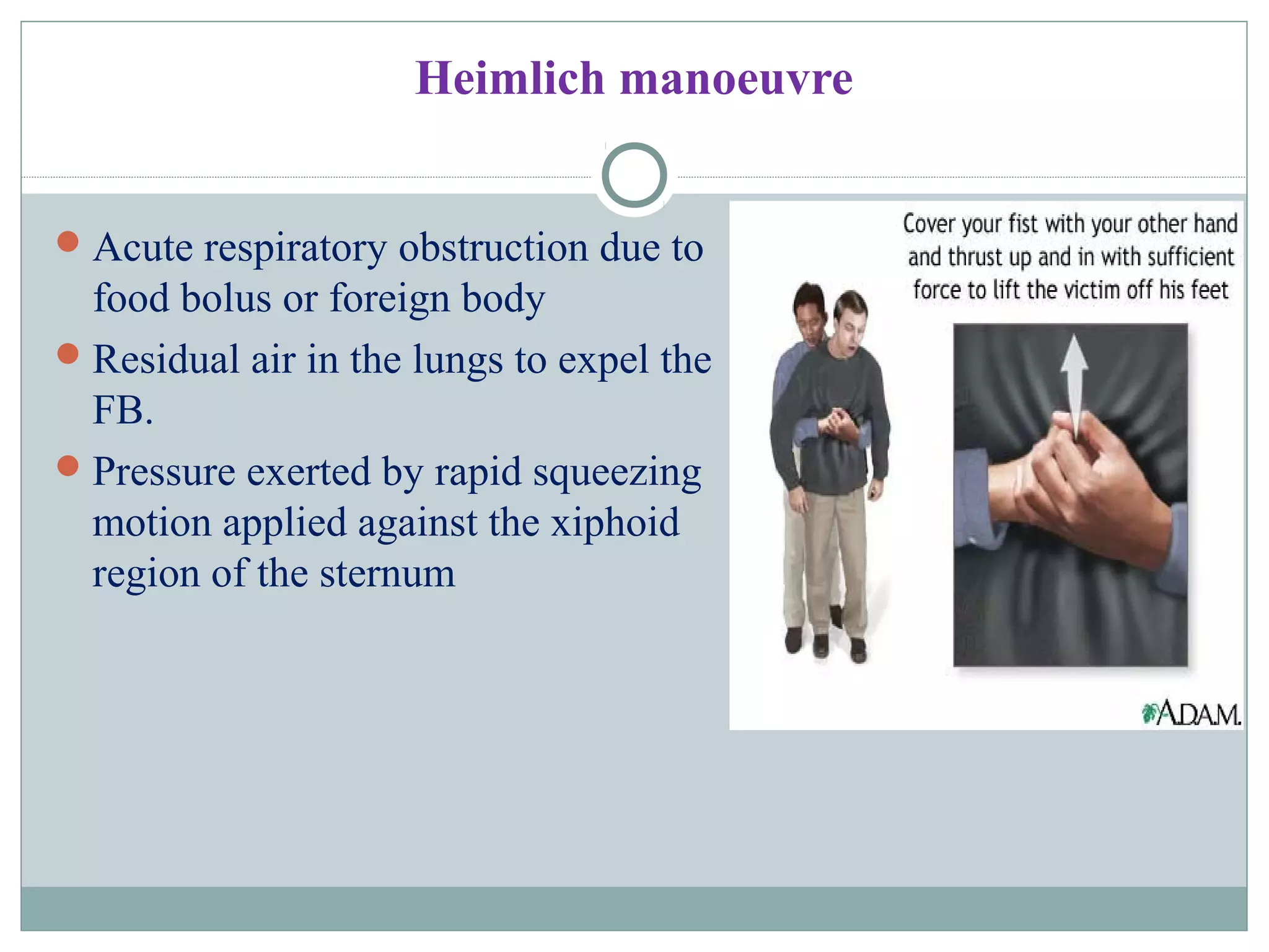 Heimlich manoeuvre
Acute respiratory obstruction due to
food bolus or foreign body
Residual air in the lungs to expel the
FB.
Pressure exerted by rapid squeezing
motion applied against the xiphoid
region of the sternum
 
