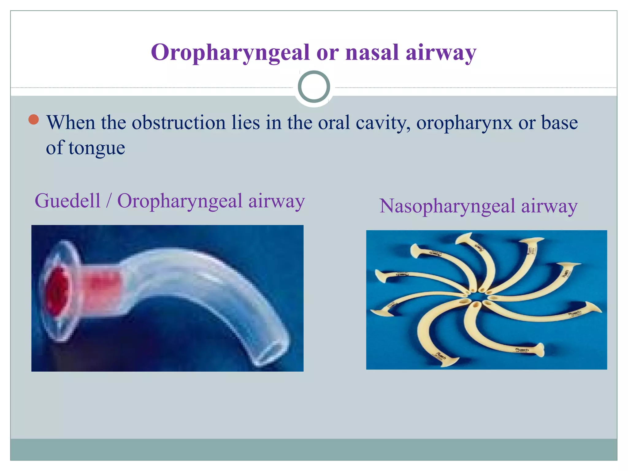 Oropharyngeal or nasal airway
When the obstruction lies in the oral cavity, oropharynx or base
of tongue
Guedell / Oropharyngeal airway Nasopharyngeal airway
 