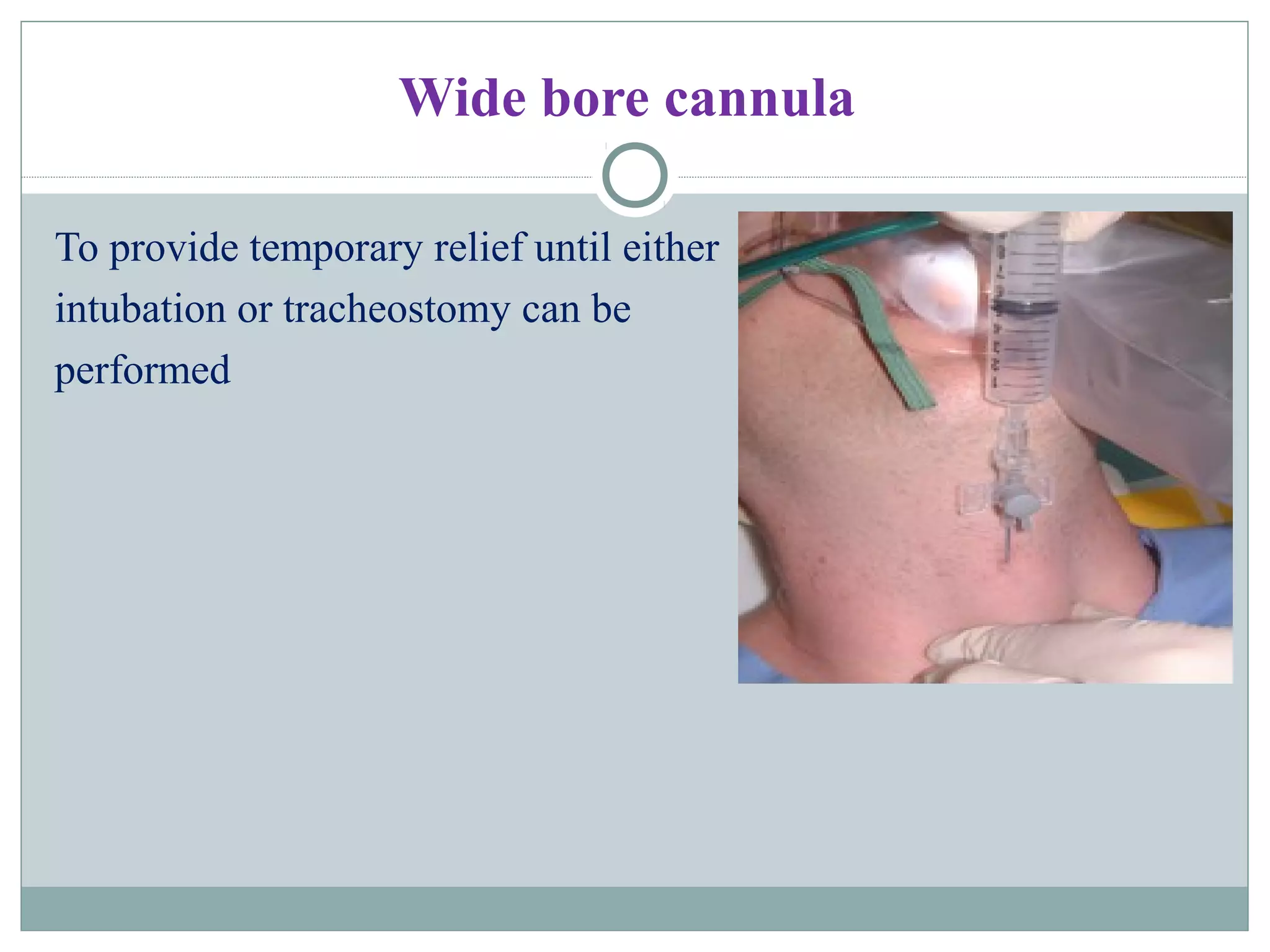 Wide bore cannula
To provide temporary relief until either
intubation or tracheostomy can be
performed
 