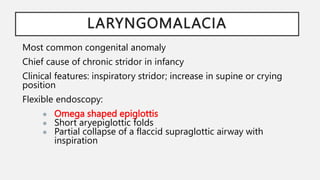 LARYNGOMALACIA
Most common congenital anomaly
Chief cause of chronic stridor in infancy
Clinical features: inspiratory stridor; increase in supine or crying
position
Flexible endoscopy:
● Omega shaped epiglottis
● Short aryepiglottic folds
● Partial collapse of a flaccid supraglottic airway with
inspiration
 