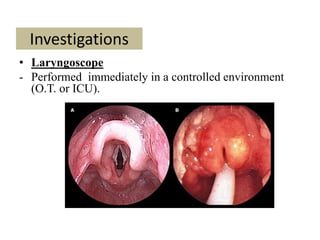 Stridor Scope An approach to a case of Paediatric Stridor | PPTX