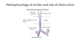 Stridor Pattern Stridor presentation pediatrics resident | PPTX