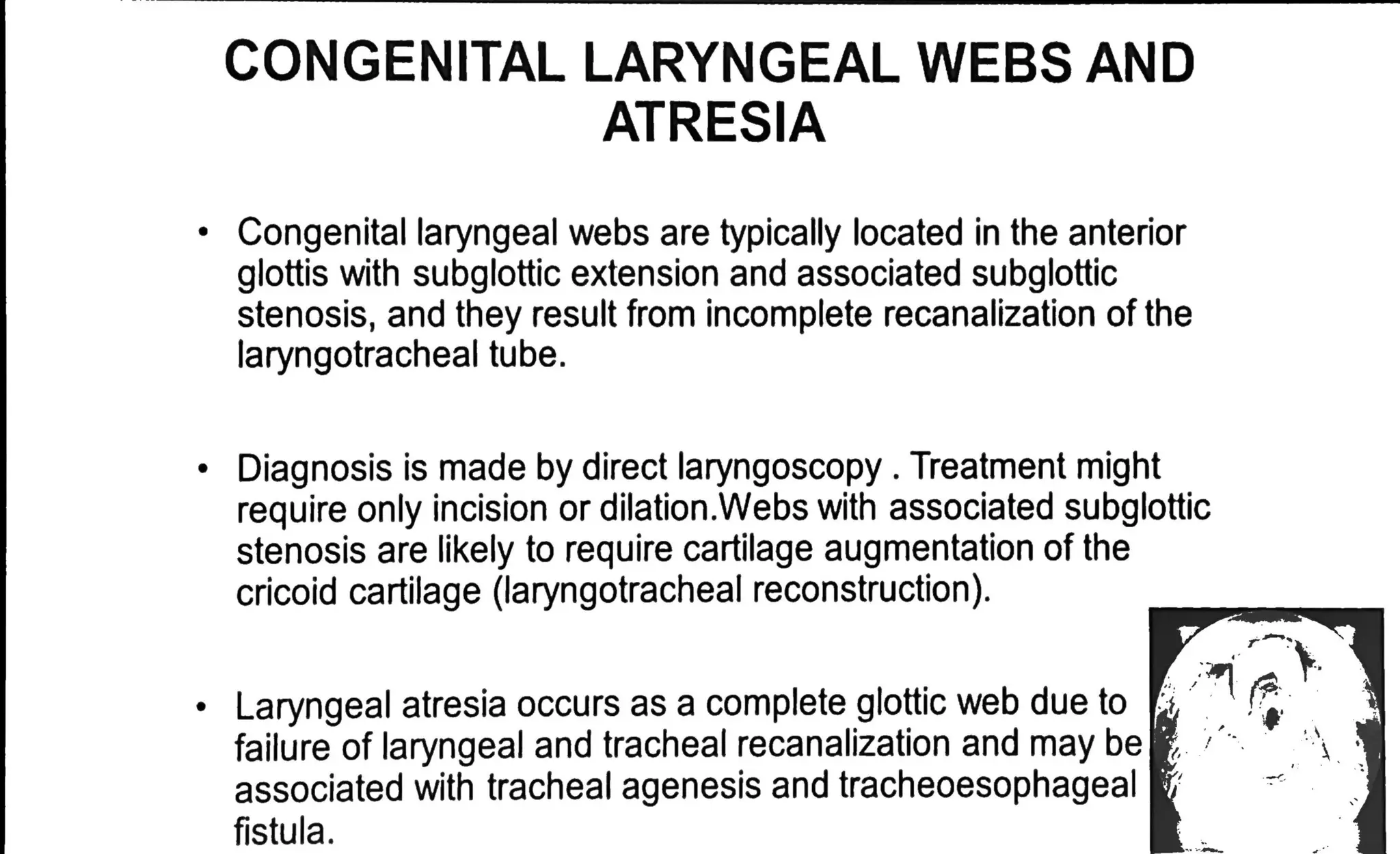 Approach to Stridor in Children - Pediatrics | PDF