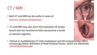 CT / MRI :
• Both CT and MRI can be useful in cases of
extrinsic tracheal compression.
• CT and MRI may also aid in the evaluation of airway
lesions but not sensitive to fully characterize a lesion
or stenotic segment.
• Helical or multidetector CT with multiplanar and 3D reconstruction offers
increasingly better definition of fixed tracheal lesions, which are effectively
‘virtual bronchoscopy’.
 