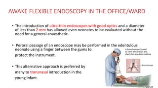 AWAKE FLEXIBLE ENDOSCOPY IN THE OFFICE/WARD
• The introduction of ultra-thin endoscopes with good optics and a diameter
of less than 2 mm has allowed even neonates to be evaluated without the
need for a general anaesthetic.
• Peroral passage of an endoscope may be performed in the edentulous
neonate using a finger between the gums to
protect the instrument.
• This alternative approach is preferred by
many to transnasal introduction in the
young infant.
 