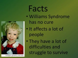 FactsWilliams Syndrome has no cureIt affects a lot of peopleThey have a lot of difficulties and struggle to survive
