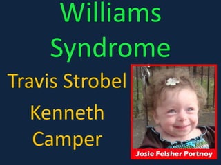 Williams Syndrome  Travis Strobel  Kenneth Camper 