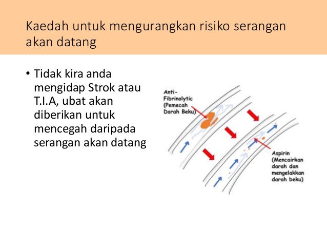 Penyakit Strok Penyakit Strok