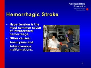 Hemorrhagic Stroke Hypertension is the most common cause of intracerebral hemorrhage. Other causes: Aneurysms and Arteriovenous malformations. 