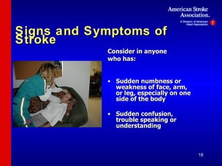 Signs and Symptoms of Stroke Consider in anyone who has: Sudden numbness or weakness of face, arm, or leg, especially on one side of the body Sudden confusion, trouble speaking or understanding 