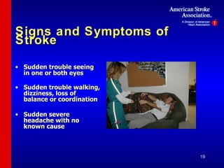Signs and Symptoms of Stroke Sudden trouble seeing in one or both eyes Sudden trouble walking, dizziness, loss of balance or coordination Sudden severe headache with no known cause 