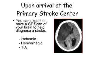 Upon arrival at the  Primary Stroke Center You can expect to have a CT Scan of your brain to help diagnose a stroke. - Ischemic - Hemorrhagic - TIA 