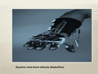 Dynamic wrist-hand orthosis (SaeboFlex).
 
