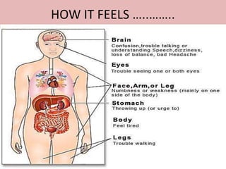 HOW IT FEELS …..……..
 