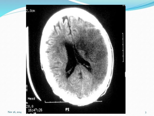 Levitra generika 20mg kaufen