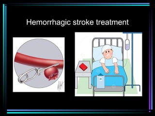 Hemorrhagic stroke treatment
 