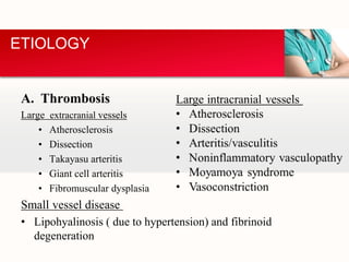 A. Thrombosis
Large extracranial vessels
• Atherosclerosis
• Dissection
• Takayasu arteritis
• Giant cell arteritis
• Fibromuscular dysplasia
Small vessel disease
• Lipohyalinosis ( due to hypertension) and fibrinoid
degeneration
ETIOLOGY
 
