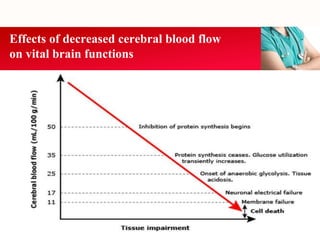 Effects of decreased cerebral blood flow
on vital brain functions
 