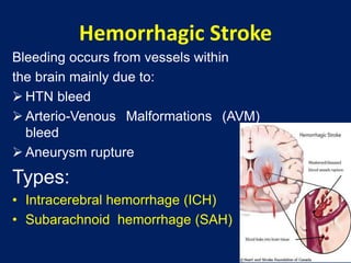 Stroke | PPTX