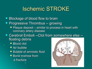Ischemic STROKEIschemic STROKE
 Blockage of blood flow to brainBlockage of blood flow to brain
 Progressive Thrombus -- growingProgressive Thrombus -- growing
 Plaque deposit – similar to process in heart withPlaque deposit – similar to process in heart with
coronary artery diseasecoronary artery disease
 Cerebral Emboli --Clot from somewhere else --Cerebral Emboli --Clot from somewhere else --
floating debrisfloating debris
 Blood clotBlood clot
 Air bubbleAir bubble
 Bubble of amniotic fluidBubble of amniotic fluid
 Bone marrow fromBone marrow from
a fracturea fracture
 