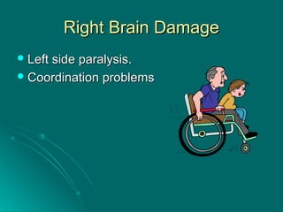 Right Brain DamageRight Brain Damage
 Left side paralysis.Left side paralysis.
 Coordination problemsCoordination problems
 