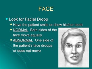 FACEFACE
 Look for Facial DroopLook for Facial Droop
Have the patient smile or show his/her teethHave the patient smile or show his/her teeth
NORMALNORMAL Both sides of theBoth sides of the
face move equallyface move equally
ABNORMALABNORMAL One side ofOne side of
the patient’s face droopsthe patient’s face droops
or does not moveor does not move
 