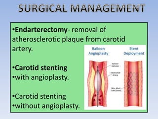 •Endarterectomy- removal of
atherosclerotic plaque from carotid
artery.
•Carotid stenting
•with angioplasty.
•Carotid stenting
•without angioplasty.
 