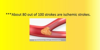 ***About 80 out of 100 strokes are ischemic strokes.
 